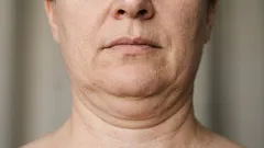 二重あごを解消するのに役立つ5つのエクササイズ